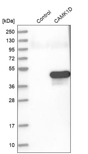 CAMKID Antibody - BSA Free Western Blot: CAMKID Antibody - BSA Free [NBP1-85589]
