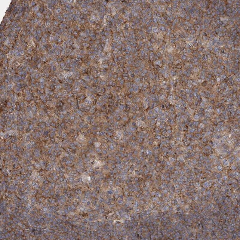 CMTM6 Antibody - BSA Free Immunohistochemistry-Paraffin: CMTM6 Antibody - BSA Free [NBP1-85590]