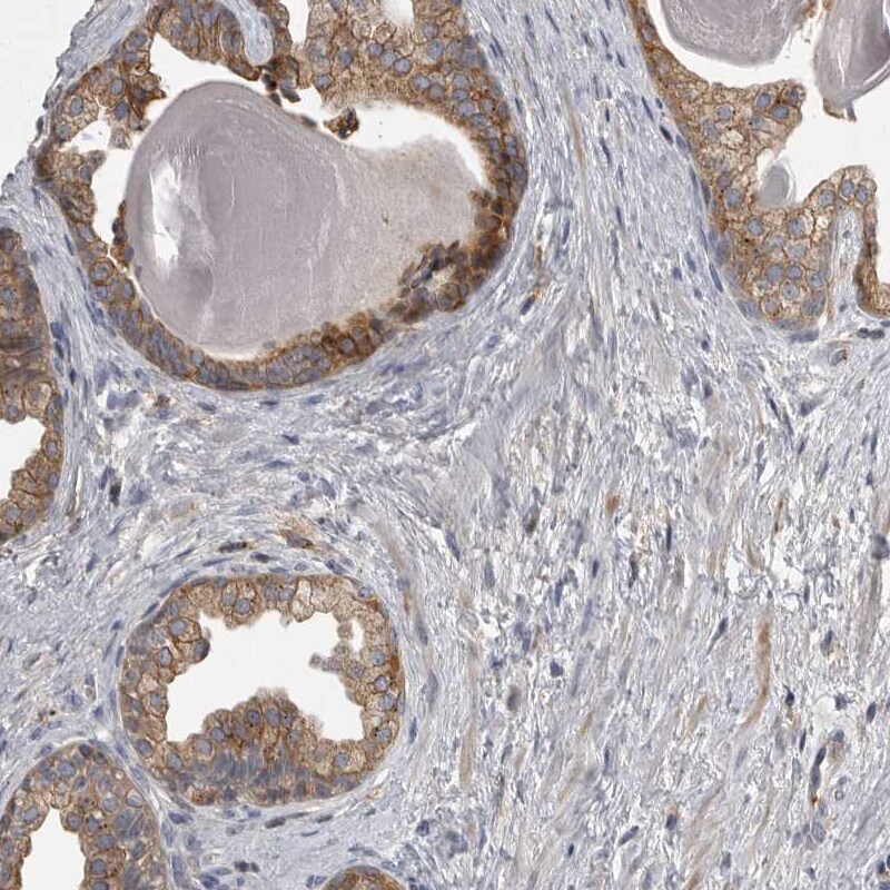 CMTM6 Antibody - BSA Free Immunohistochemistry-Paraffin: CMTM6 Antibody - BSA Free [NBP1-85590]