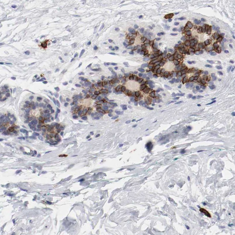 CD117/c-kit Antibody - BSA Free Immunohistochemistry-Paraffin: CD117/c-kit Antibody - BSA Free [NBP1-85593]