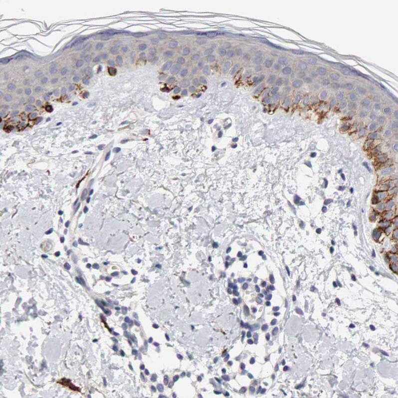CD117/c-kit Antibody - BSA Free Immunohistochemistry-Paraffin: CD117/c-kit Antibody - BSA Free [NBP1-85593]