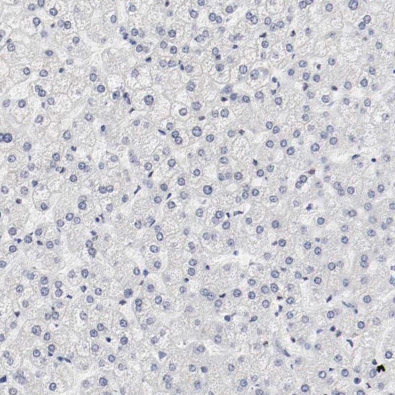 CD117/c-kit Antibody - BSA Free Immunohistochemistry-Paraffin: CD117/c-kit Antibody - BSA Free [NBP1-85593]