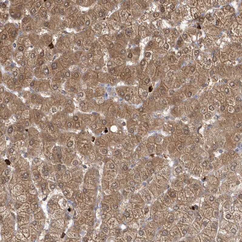 RNF7 Antibody - BSA Free Immunohistochemistry-Paraffin: RNF7 Antibody - BSA Free [NBP1-85594]