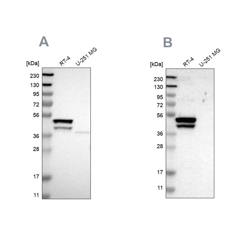 KRT23 Antibody - BSA Free Western Blot: KRT23 Antibody - BSA Free [NBP1-85597]