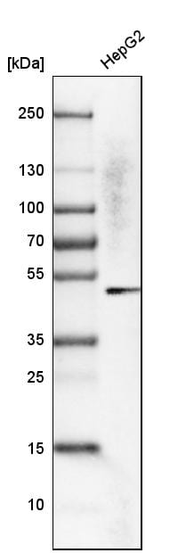 KRT23 Antibody - BSA Free Western Blot: KRT23 Antibody - BSA Free [NBP1-85597]