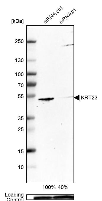 KRT23 Antibody - BSA Free Western Blot: KRT23 Antibody - BSA Free [NBP1-85597]