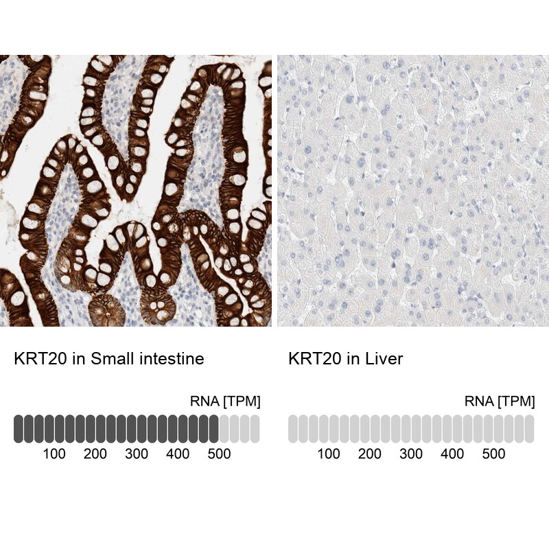 Cytokeratin 20 Antibody - BSA Free Immunohistochemistry-Paraffin: Cytokeratin 20 Antibody - BSA Free [NBP1-85599]
