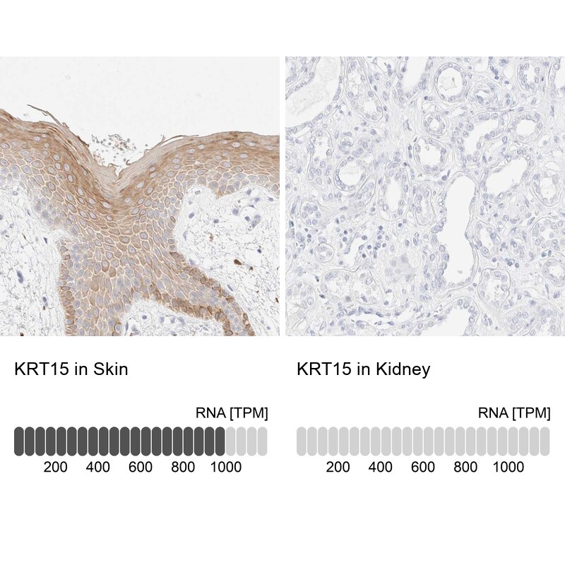 Cytokeratin 15 Antibody - BSA Free Immunohistochemistry-Paraffin: Cytokeratin 15 Antibody - BSA Free [NBP1-85602]