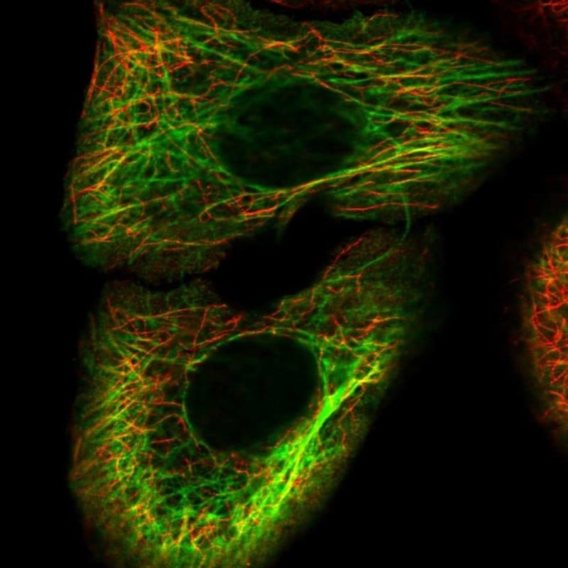 Cytokeratin 15 Antibody - BSA Free Immunocytochemistry/ Immunofluorescence: Cytokeratin 15 Antibody [NBP1-85603]