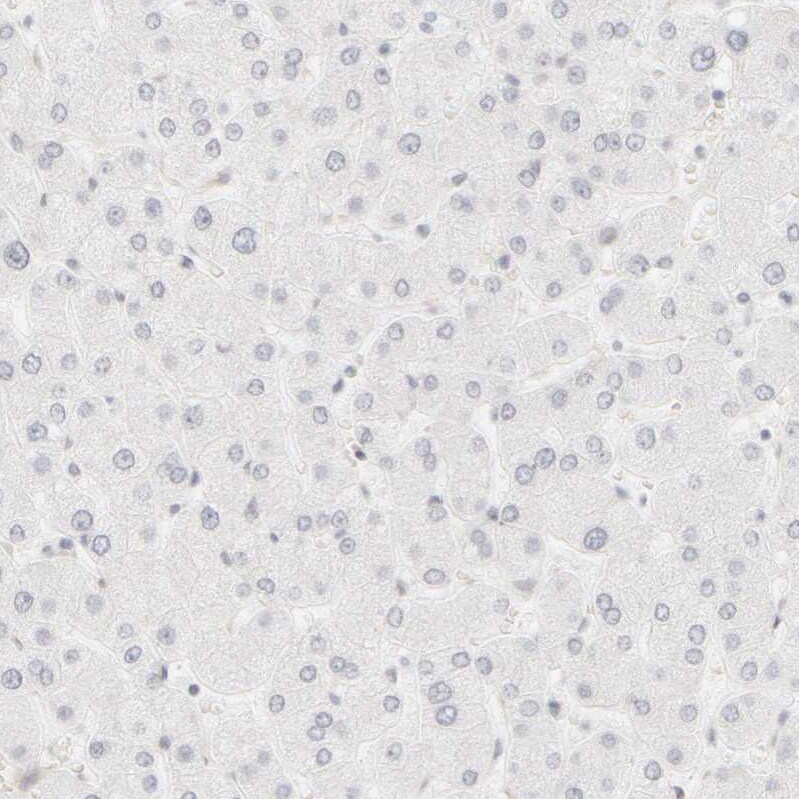 Cytokeratin 15 Antibody - BSA Free Immunohistochemistry-Paraffin: Cytokeratin 15 Antibody - BSA Free [NBP1-85603]