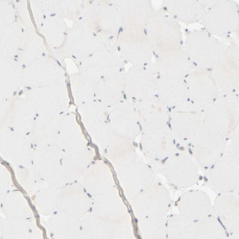 Cytokeratin 15 Antibody - BSA Free Immunohistochemistry-Paraffin: Cytokeratin 15 Antibody - BSA Free [NBP1-85603]
