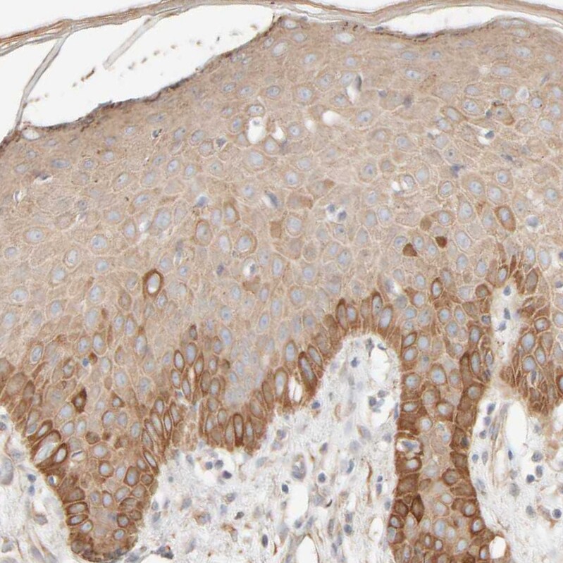 Cytokeratin 15 Antibody - BSA Free Immunohistochemistry-Paraffin: Cytokeratin 15 Antibody - BSA Free [NBP1-85603]