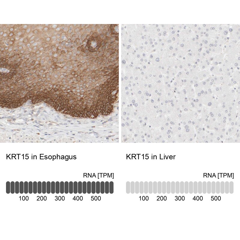 Cytokeratin 15 Antibody - BSA Free Immunohistochemistry-Paraffin: Cytokeratin 15 Antibody - BSA Free [NBP1-85603]