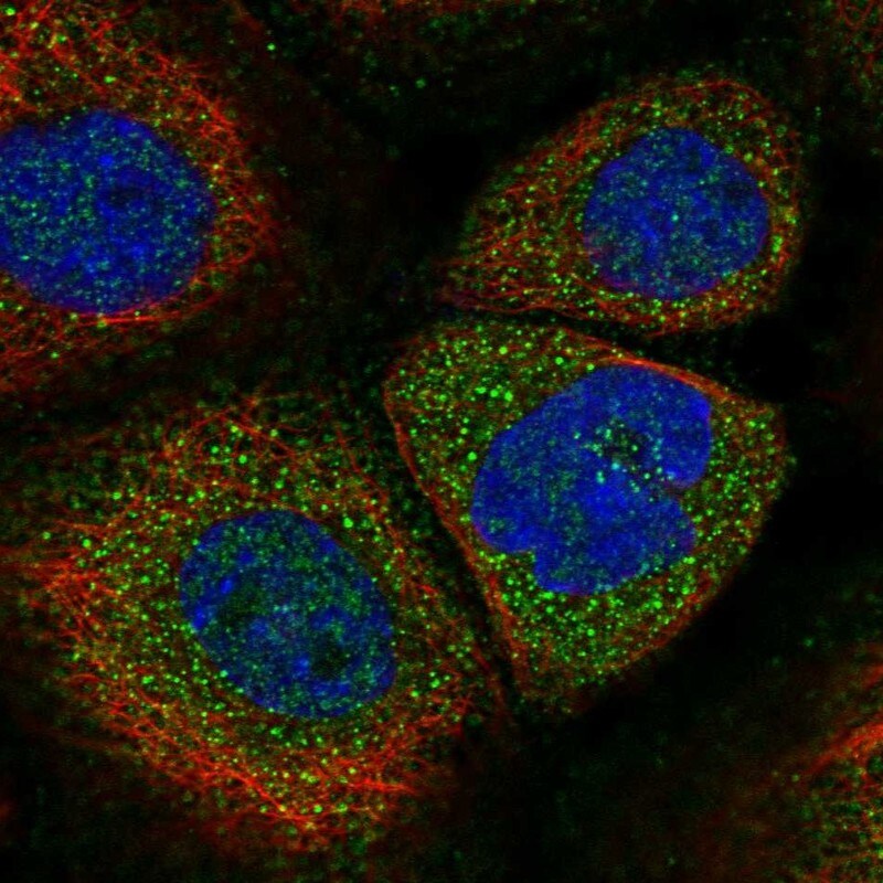 SOCS-5 Antibody - BSA Free Immunocytochemistry/ Immunofluorescence: SOCS-5 Antibody [NBP1-85608]