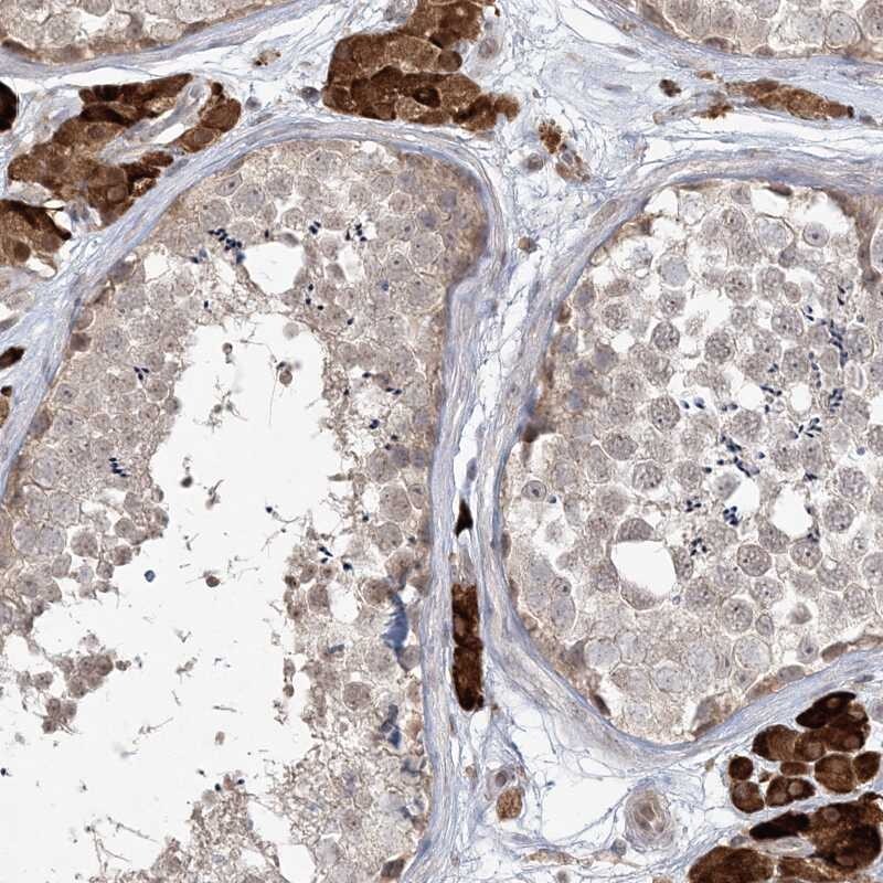 CARD6 Antibody - BSA Free Immunohistochemistry-Paraffin: CARD6 Antibody [NBP1-85613]