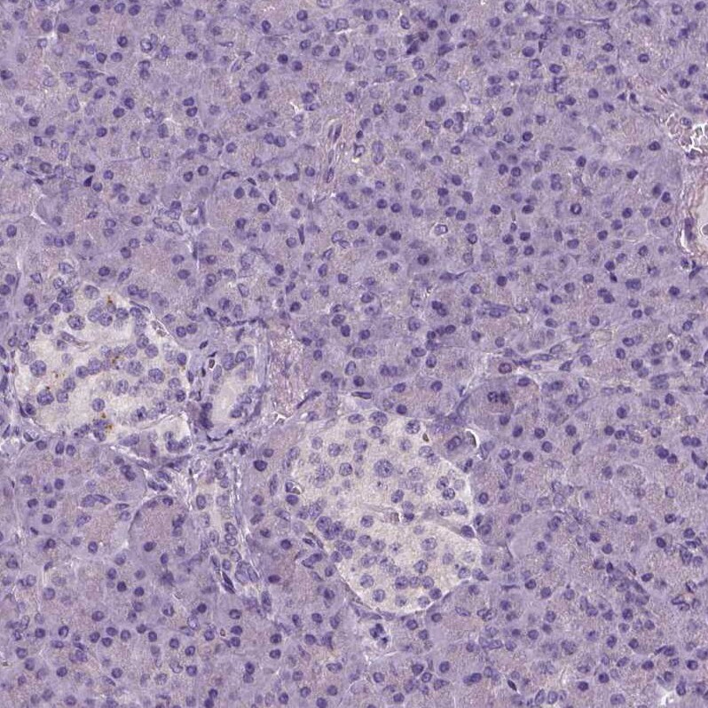 ELOVL3 Antibody - BSA Free Immunohistochemistry-Paraffin: ELOVL3 Antibody - BSA Free [NBP1-85618]