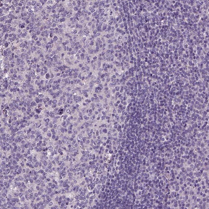 ELOVL3 Antibody - BSA Free Immunohistochemistry-Paraffin: ELOVL3 Antibody - BSA Free [NBP1-85618]