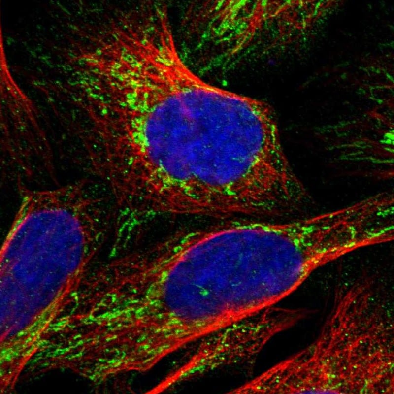 NDUFV3 Antibody - BSA Free Immunocytochemistry/ Immunofluorescence: NDUFV3 Antibody [NBP1-85622]