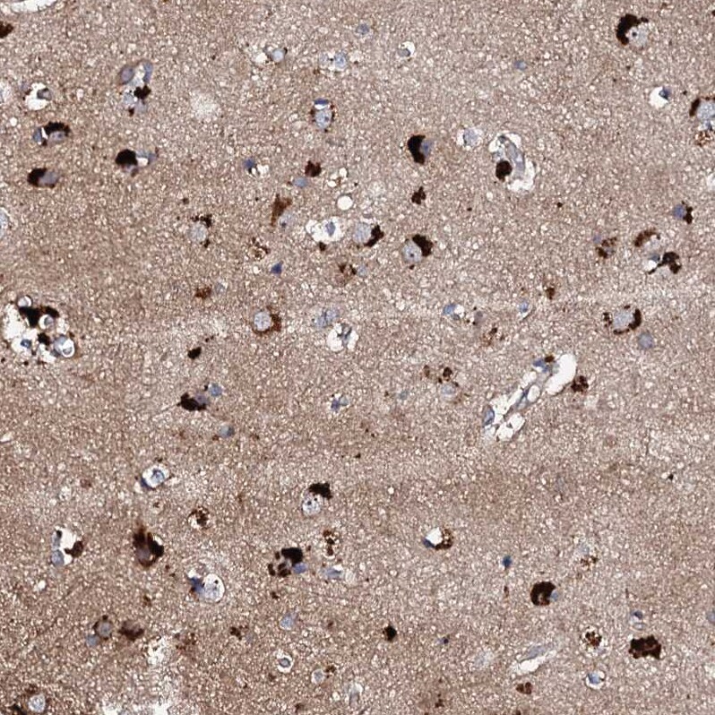 ch-TOG Antibody - BSA Free Immunohistochemistry-Paraffin: ch-TOG Antibody - BSA Free [NBP1-85624]