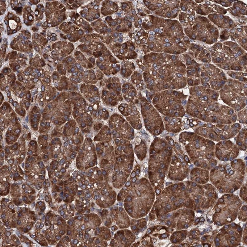 ch-TOG Antibody - BSA Free Immunohistochemistry: ch-TOG Antibody - BSA Free [NBP1-85625]