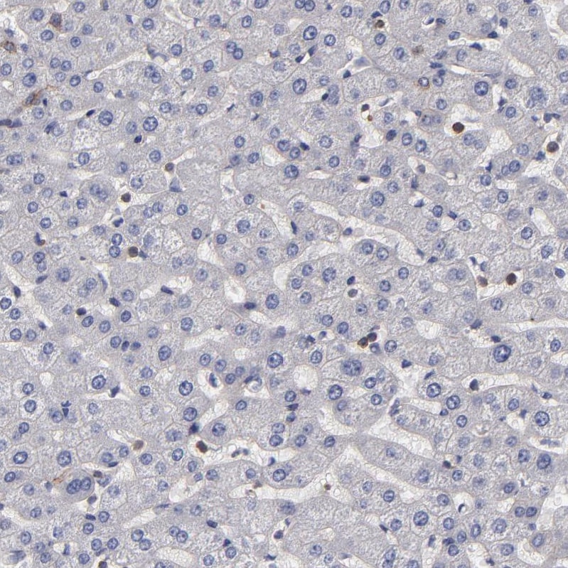 FAM62B Antibody - BSA Free Immunohistochemistry-Paraffin: FAM62B Antibody - BSA Free [NBP1-85627]