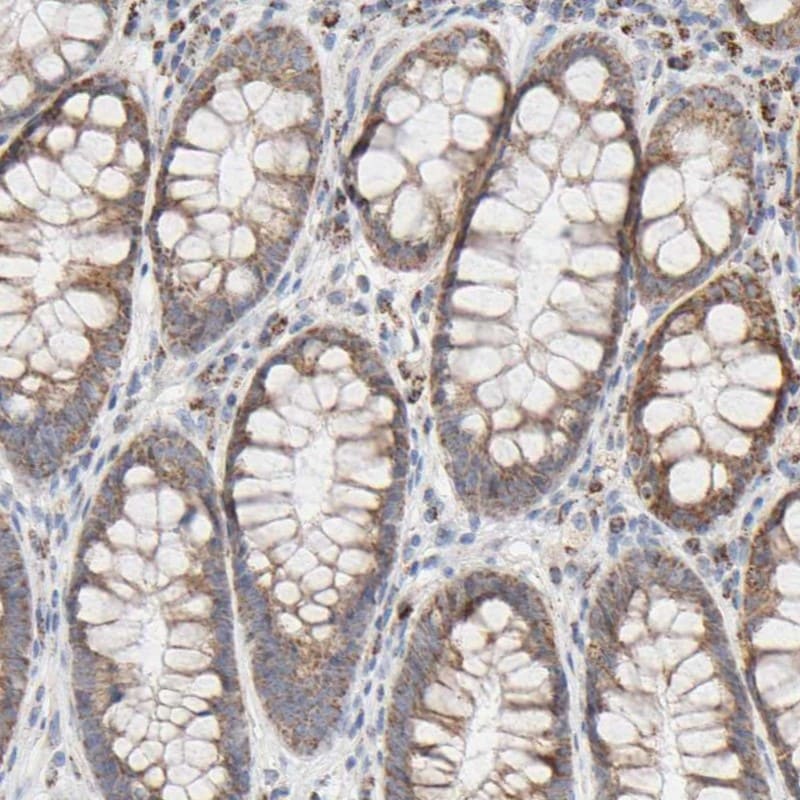 SYT16 Antibody - BSA Free Immunohistochemistry-Paraffin: SYT16 Antibody - BSA Free [NBP1-85628]