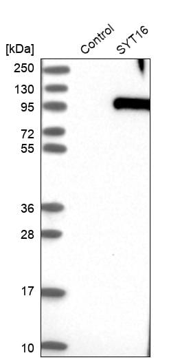 SYT16 Antibody - BSA Free Western Blot: SYT16 Antibody - BSA Free [NBP1-85628]