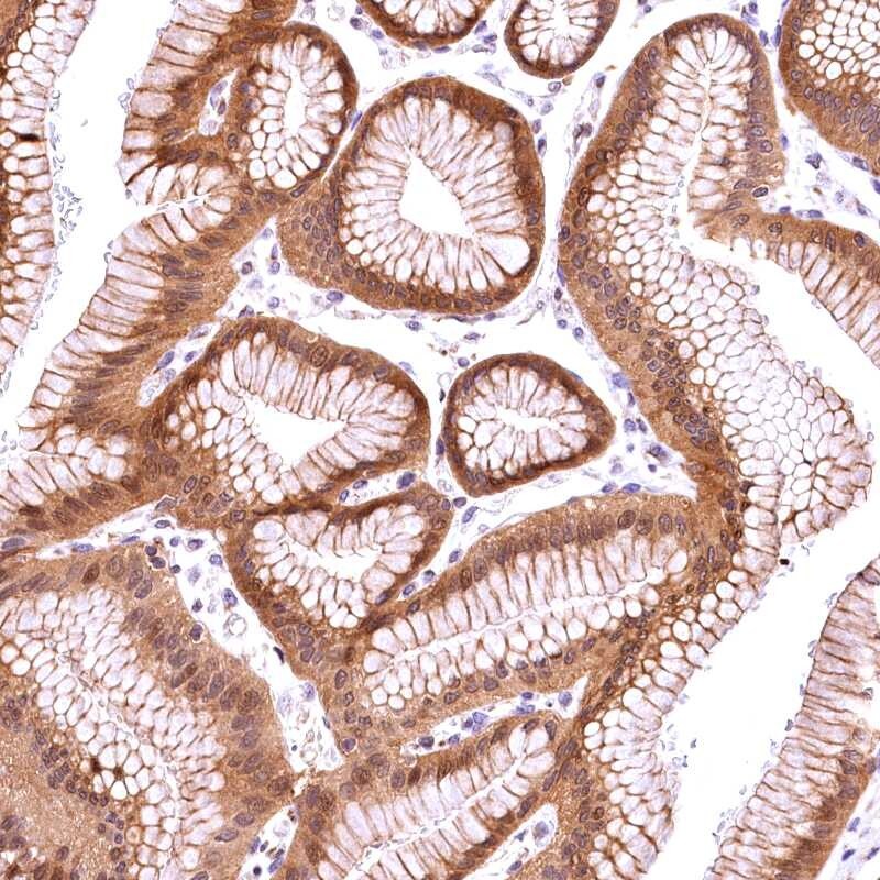 CHORDC1 Antibody - BSA Free Immunohistochemistry-Paraffin: CHORDC1 Antibody [NBP1-85629]