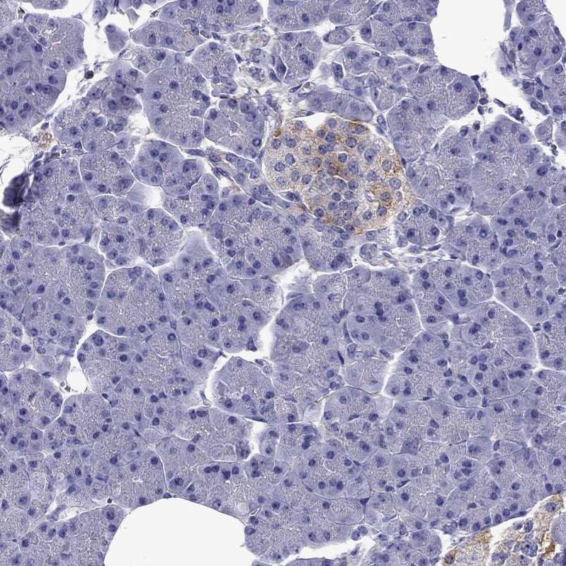 Chromogranin C Antibody - BSA Free Immunohistochemistry-Paraffin: Chromogranin C Antibody - BSA Free [NBP1-85631]