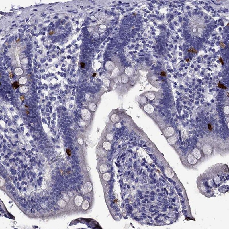Chromogranin C Antibody - BSA Free Immunohistochemistry-Paraffin: Chromogranin C Antibody - BSA Free [NBP1-85631]