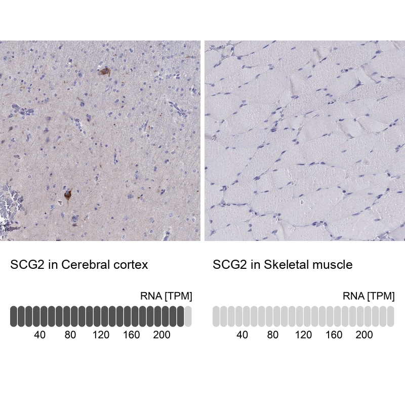 Chromogranin C Antibody - BSA Free Immunohistochemistry-Paraffin: Chromogranin C Antibody - BSA Free [NBP1-85631]