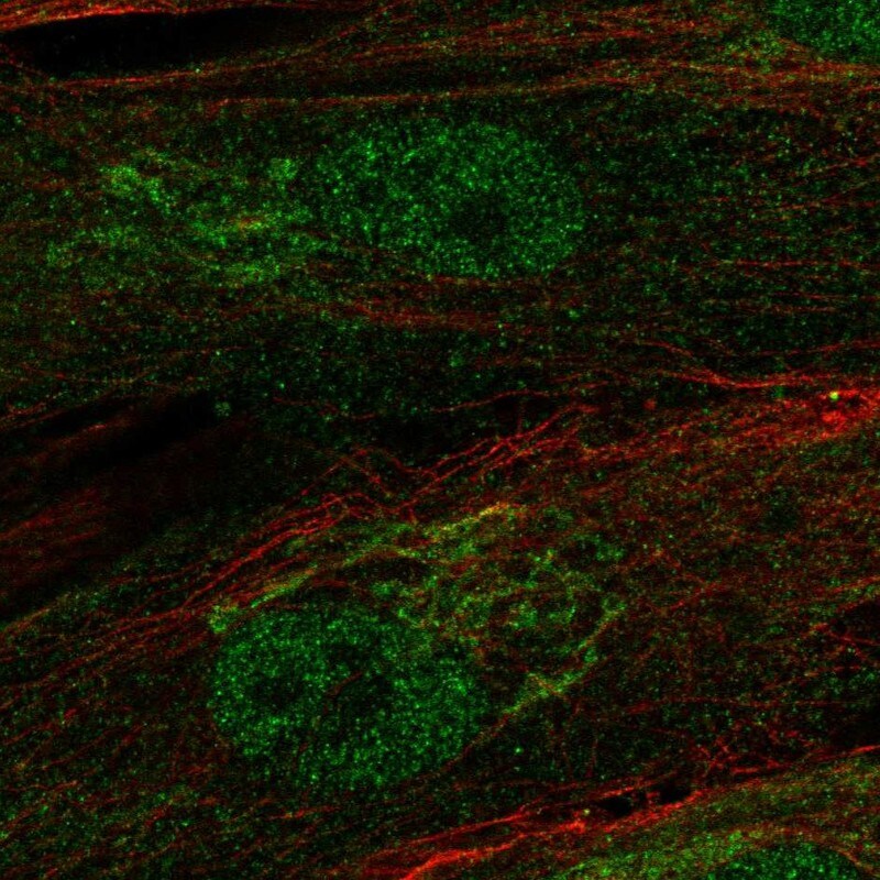 RCBTB2 Antibody - BSA Free Immunocytochemistry/ Immunofluorescence: RCBTB2 Antibody [NBP1-85636]