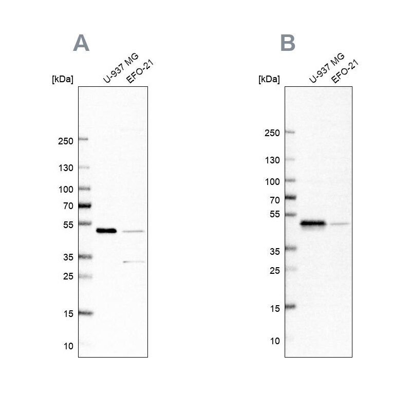 RCC1 Antibody - BSA Free Western Blot: RCC1 Antibody - BSA Free [NBP1-85637]