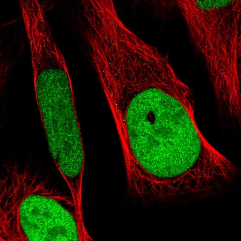 RCC1 Antibody - BSA Free Immunocytochemistry/ Immunofluorescence: RCC1 Antibody [NBP1-85638]