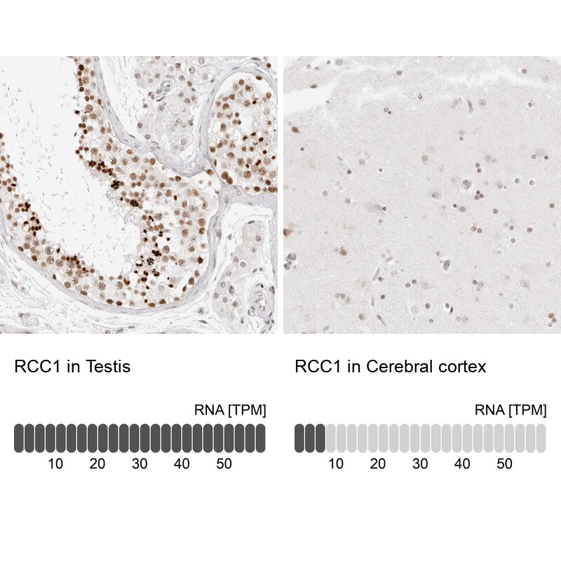RCC1 Antibody - BSA Free Immunohistochemistry-Paraffin: RCC1 Antibody - BSA Free [NBP1-85638]