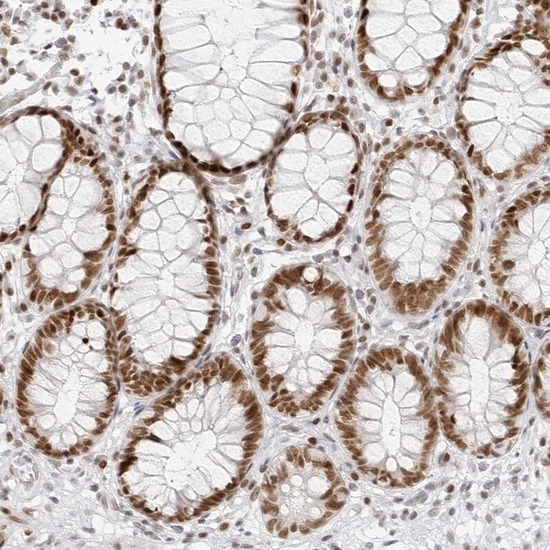 RCC1 Antibody - BSA Free Immunohistochemistry-Paraffin: RCC1 Antibody - BSA Free [NBP1-85638]
