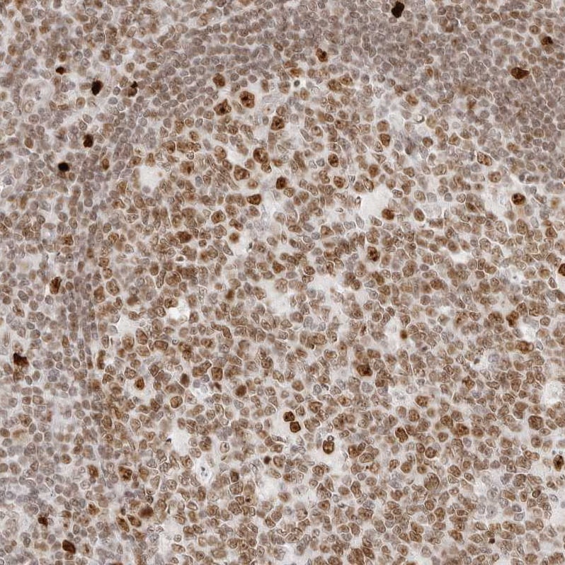 RCC1 Antibody - BSA Free Immunohistochemistry-Paraffin: RCC1 Antibody - BSA Free [NBP1-85638]