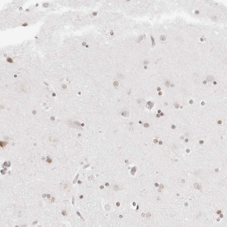 RCC1 Antibody - BSA Free Immunohistochemistry-Paraffin: RCC1 Antibody - BSA Free [NBP1-85638]