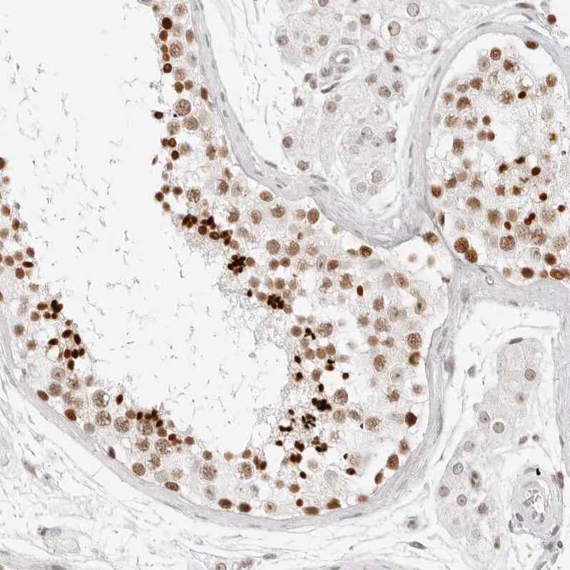 RCC1 Antibody - BSA Free Immunohistochemistry-Paraffin: RCC1 Antibody - BSA Free [NBP1-85638]