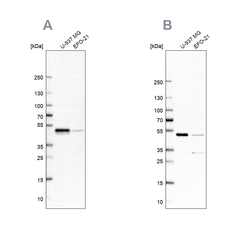 RCC1 Antibody - BSA Free Western Blot: RCC1 Antibody - BSA Free [NBP1-85638]