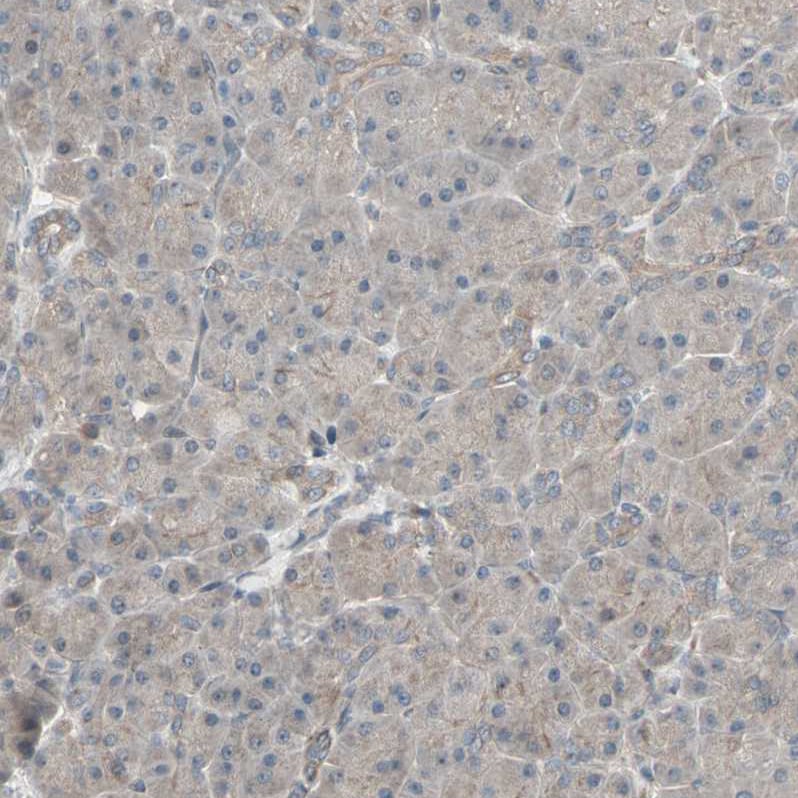 CRLR Antibody - BSA Free Immunohistochemistry-Paraffin: CRLR Antibody - BSA Free [NBP1-85643]
