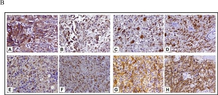 CRLR Antibody - BSA Free