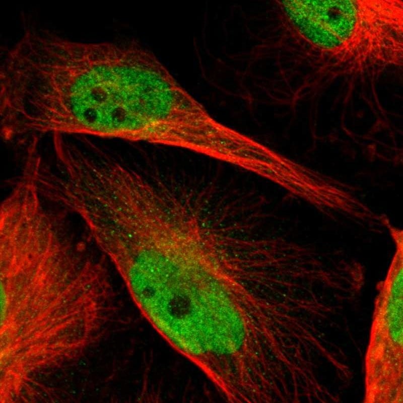 CGR19 Antibody - BSA Free Immunocytochemistry/ Immunofluorescence: CGR19 Antibody - BSA Free [NBP1-85644]