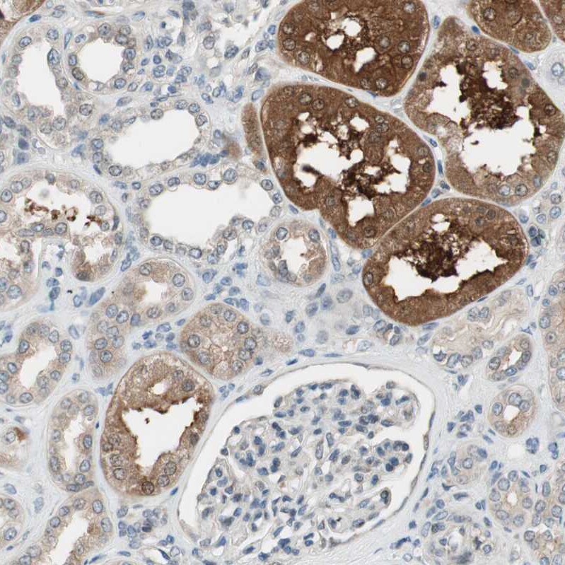 CGR19 Antibody - BSA Free Immunohistochemistry-Paraffin: CGR19 Antibody - BSA Free [NBP1-85644]