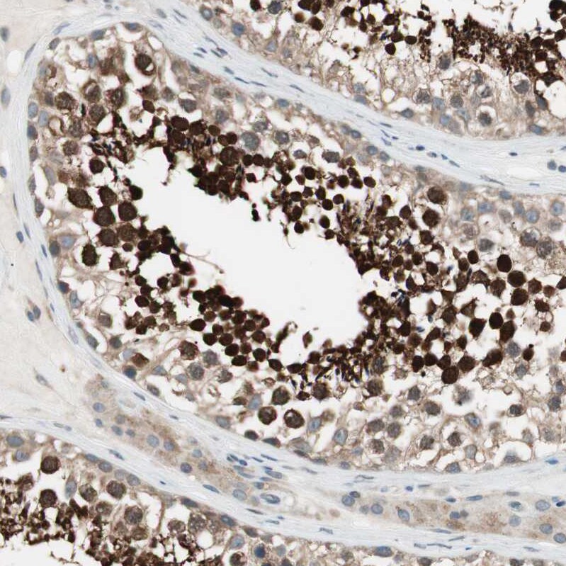 CGR19 Antibody - BSA Free Immunohistochemistry-Paraffin: CGR19 Antibody - BSA Free [NBP1-85644]