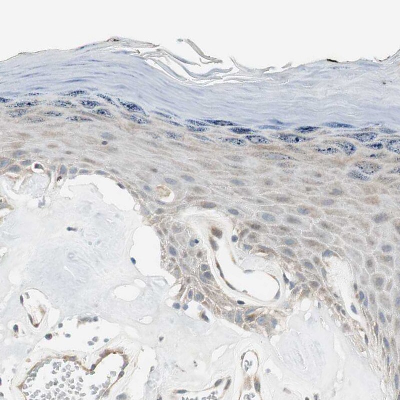 CGR19 Antibody - BSA Free Immunohistochemistry-Paraffin: CGR19 Antibody - BSA Free [NBP1-85644]
