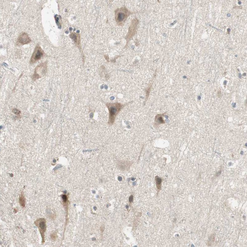 CGR19 Antibody - BSA Free Immunohistochemistry-Paraffin: CGR19 Antibody - BSA Free [NBP1-85644]