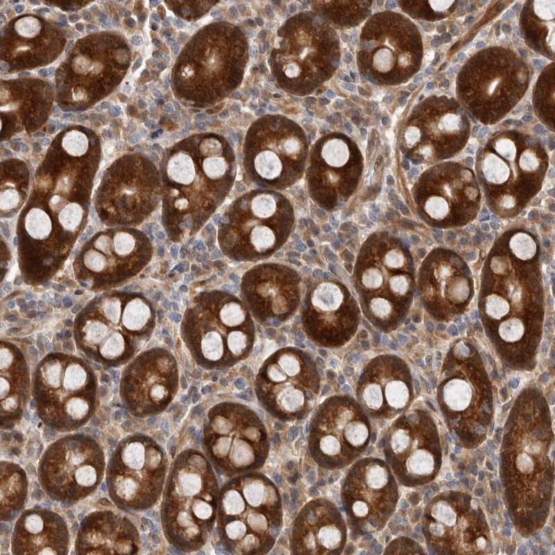 Ribosome maturation protein SBDS Antibody - BSA Free Immunohistochemistry-Paraffin: Ribosome maturation protein SBDS Antibody [NBP1-85646]