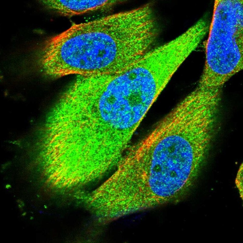 Ribosome maturation protein SBDS Antibody - BSA Free Immunocytochemistry/ Immunofluorescence: Ribosome maturation protein SBDS Antibody - BSA Free [NBP1-85646]