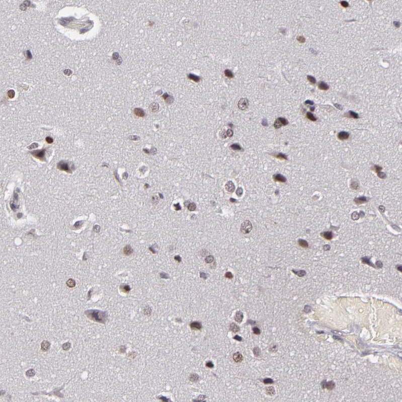 RRP7A Antibody - BSA Free Immunohistochemistry-Paraffin: RRP7A Antibody - BSA Free [NBP1-85647]